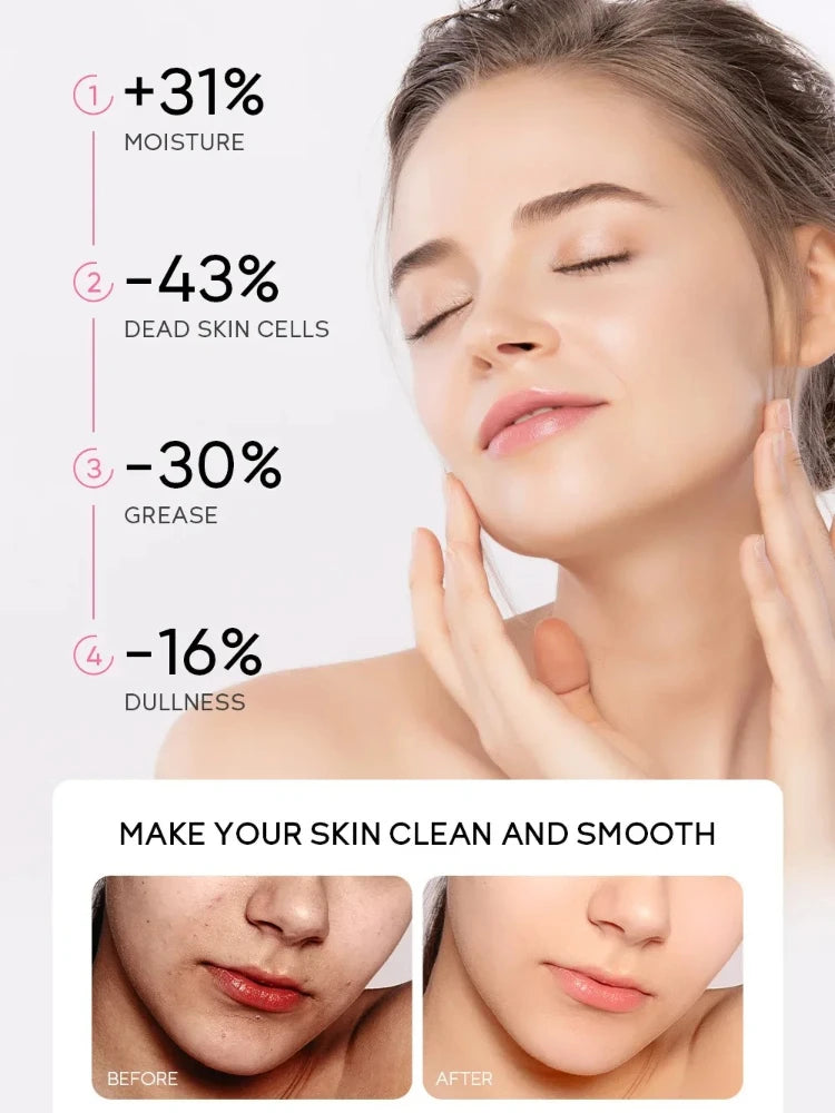 Sakura Exfoliating Peeling Gel – Hydrate & Smooth Skin