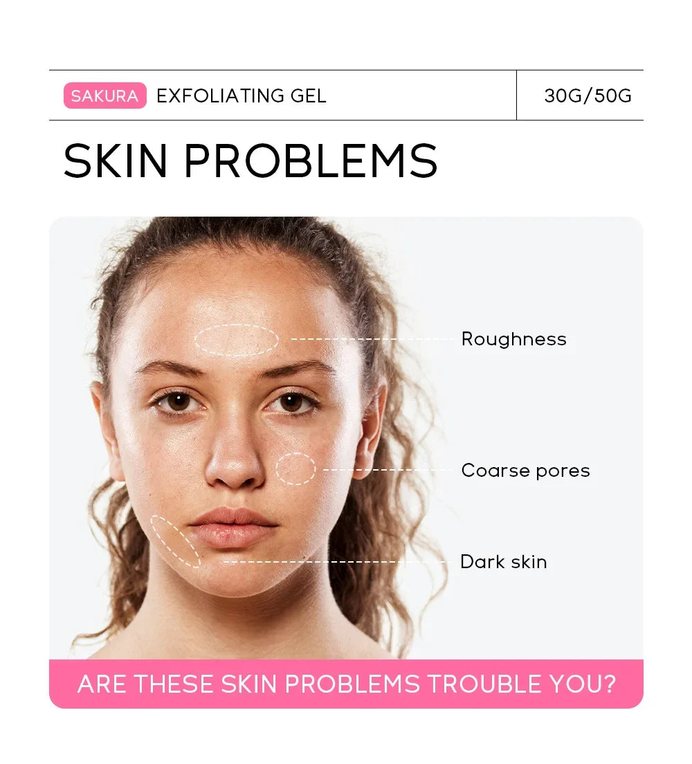 Sakura Exfoliating Peeling Gel – Hydrate & Smooth Skin